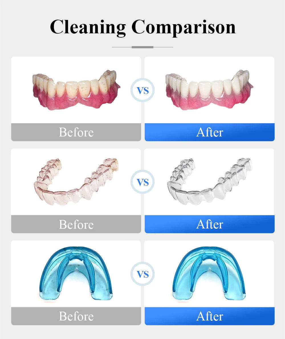 Tullker Ultrasonic Retainer Cleaner For Dentures Jewelry